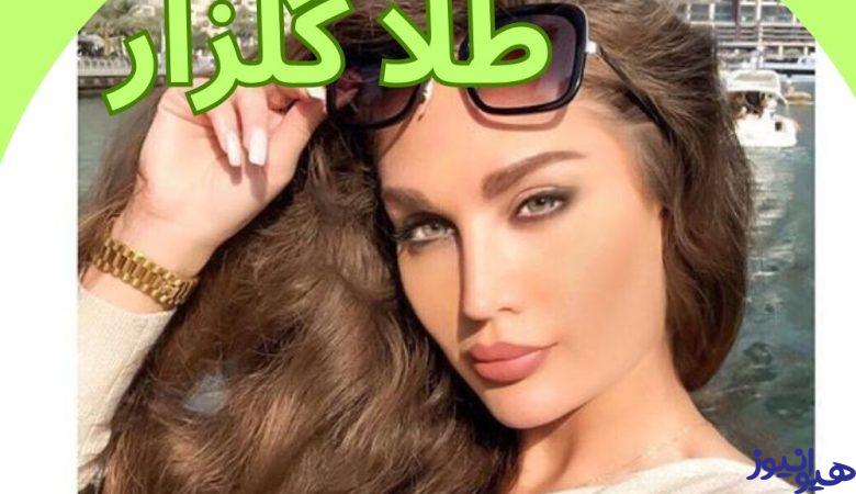 طلا گلزار