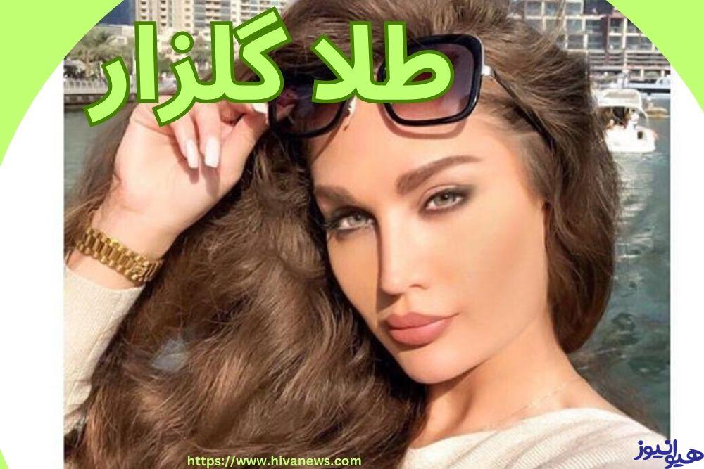 طلا گلزار
