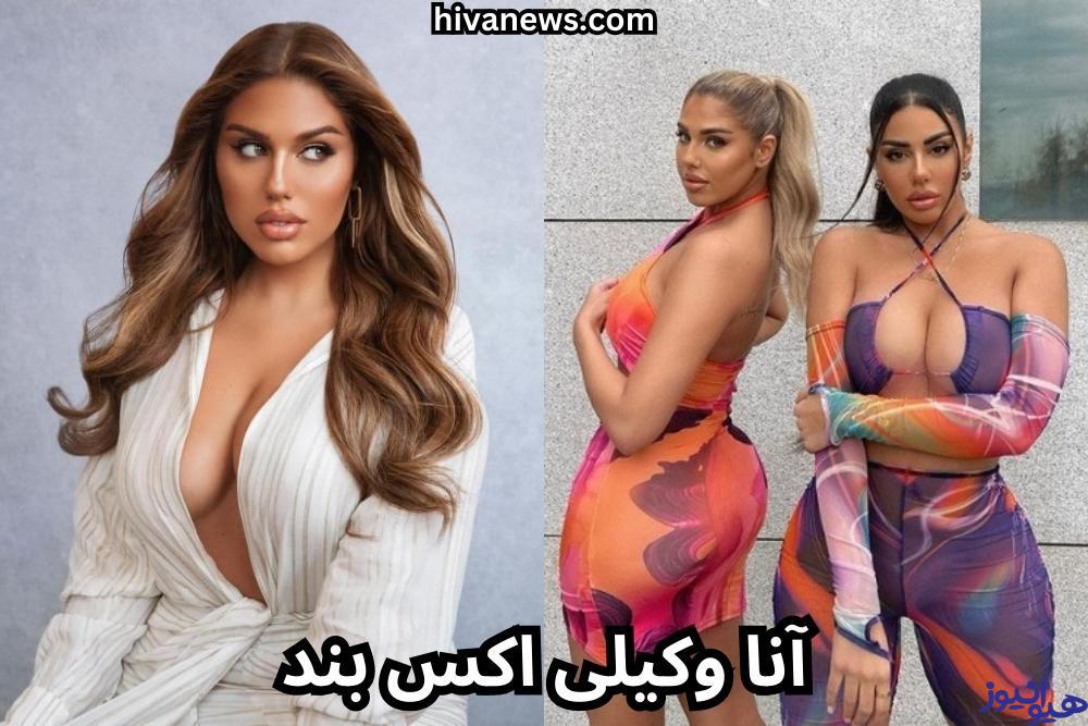 آنا وکیلی اکس بند