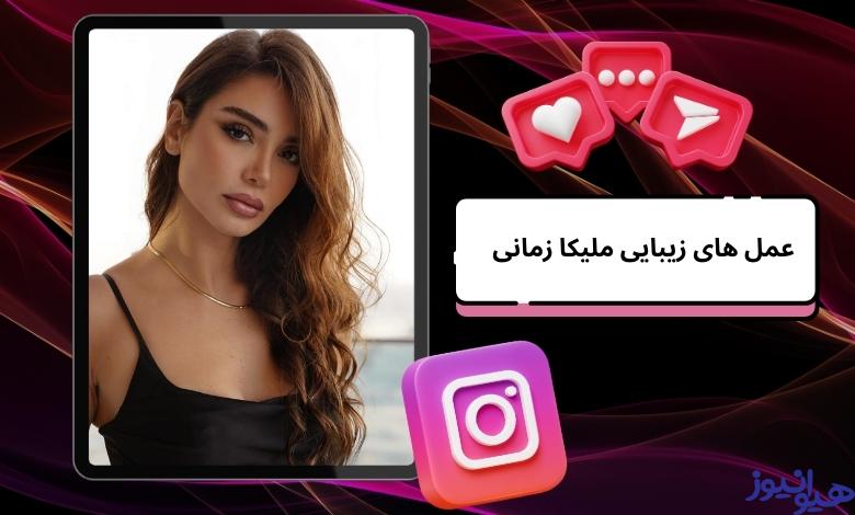 عمل های زیبایی ملیکا زمانی