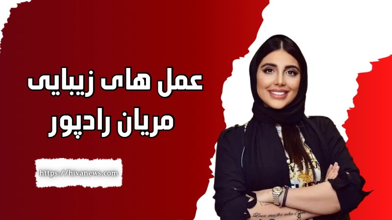 عمل های زیبایی مریان رادپور